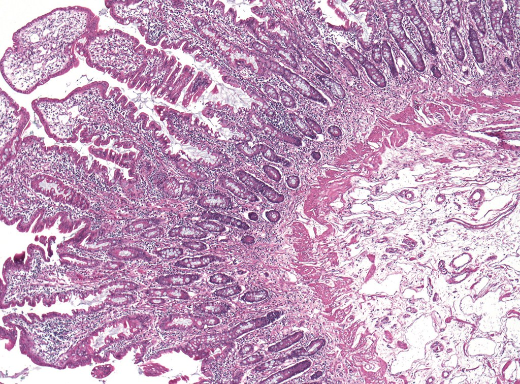 Why is gut health so important?