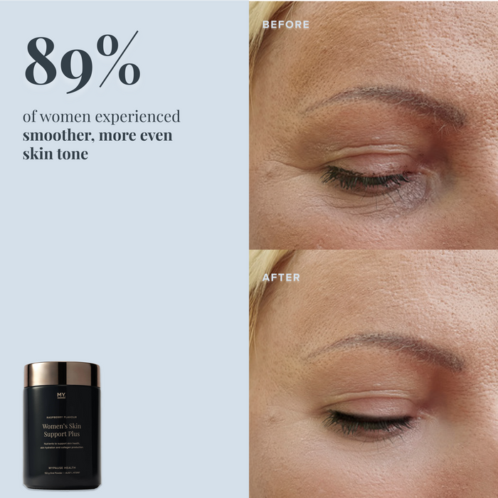 Women's Skin Support Plus